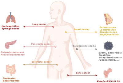 Bacterial DNA involvement in carcinogenesis